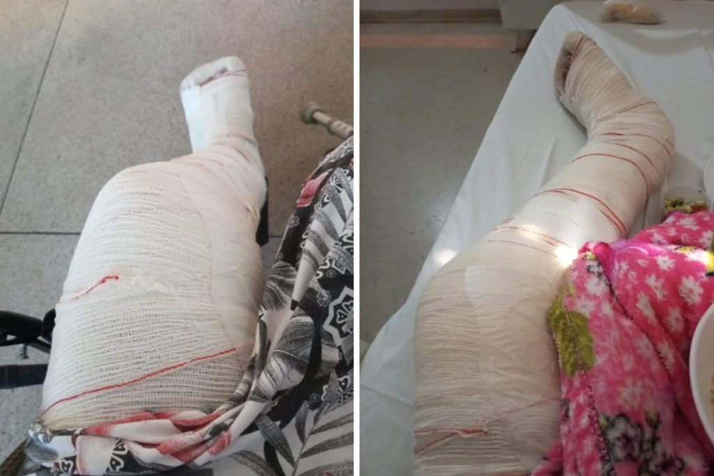 Tocantins tem mais de 4 mil casos de violência contra a mulher em 2025: ‘Me derrubou e torceu minha perna’, diz vítima